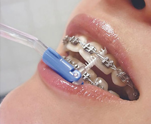 Сколько стоит лечение одного зуба в чебоксарах